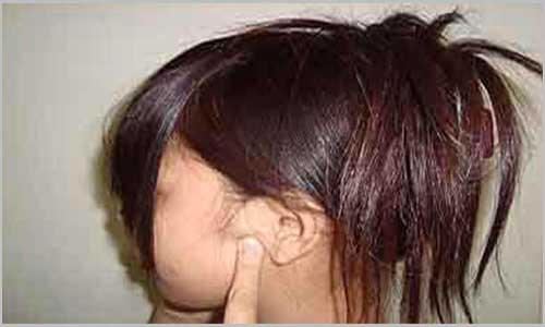 Be Careful of a Lump in Any Part of the Body