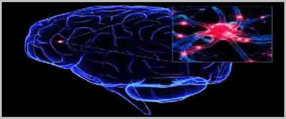 Epilepsy